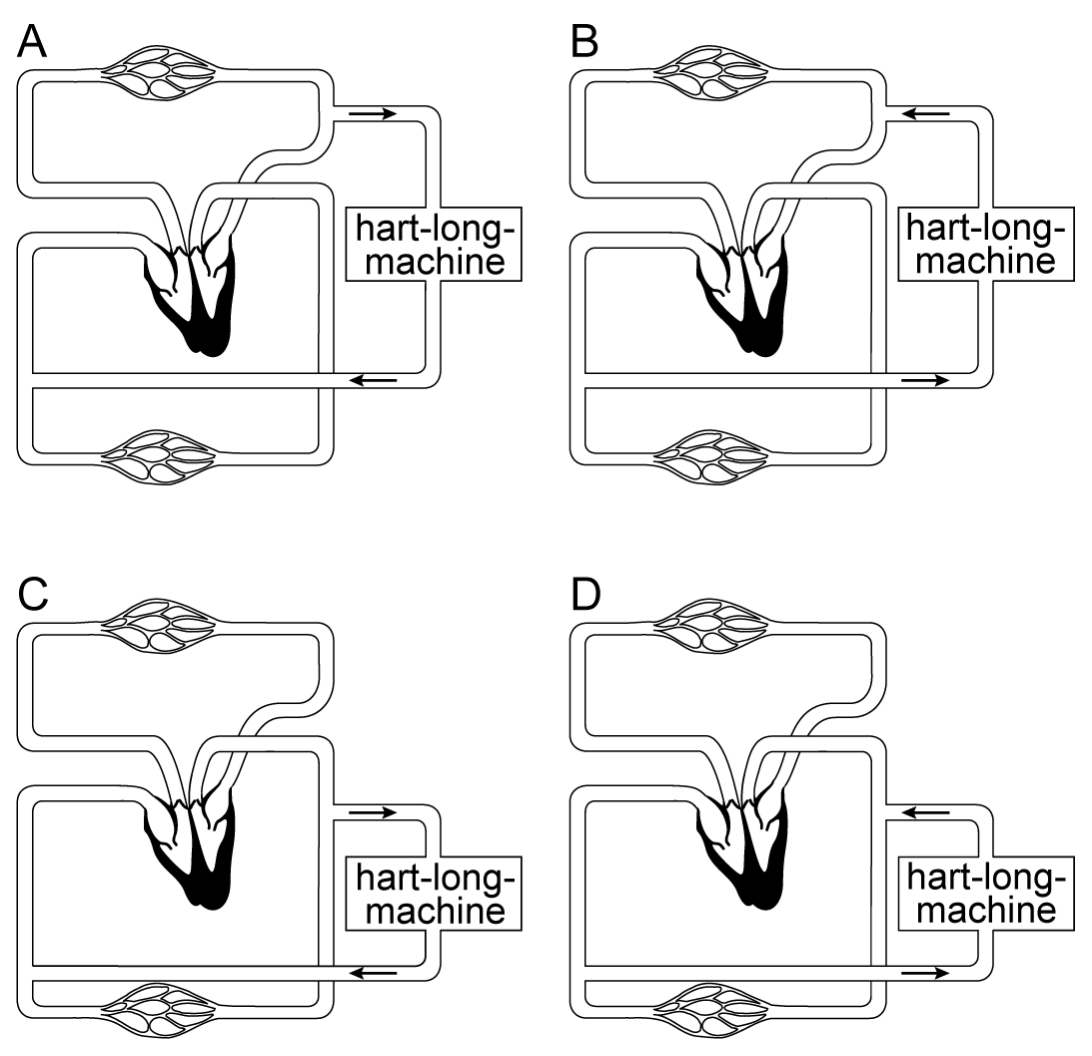 Figuur 1 bij vraag 4 van opgave De tetralogie van Fallot (Biologie HAVO 2025)
