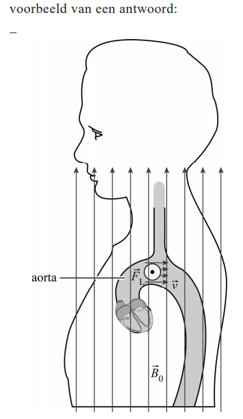 Antwoordmodel vraag 11 ECG in MRI, figuur 1